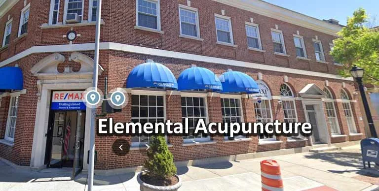 Elemental Acupuncture